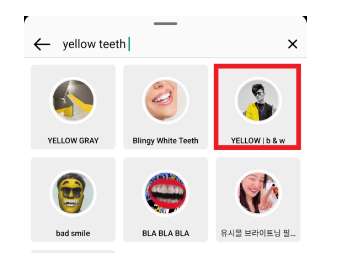 filtro denti gialli